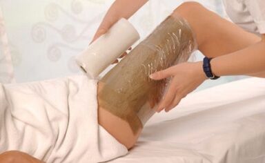 It is possible for children enveloped for varicose veins