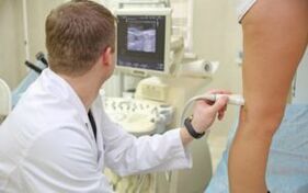 Methods for treating varicose veins in women in women