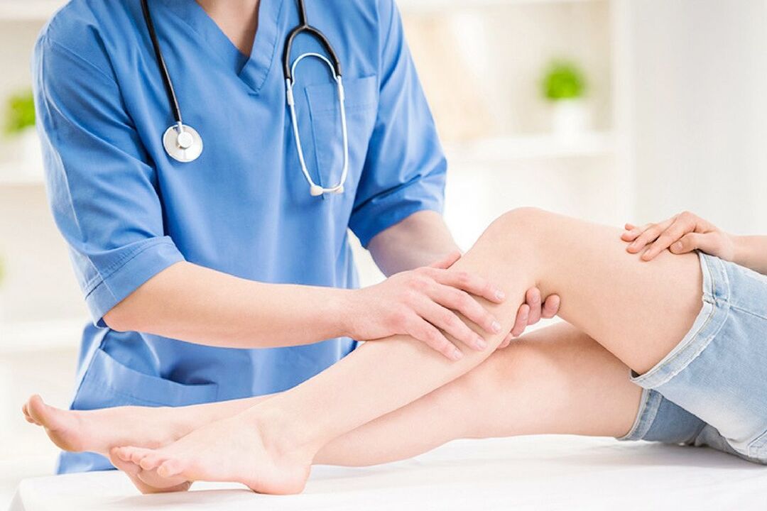 varicose vein symptoms